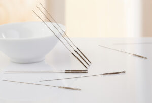 functional medicine and acupuncture