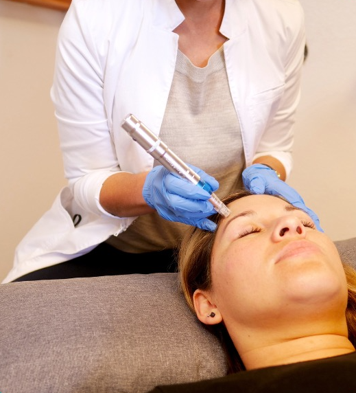 Microneedling